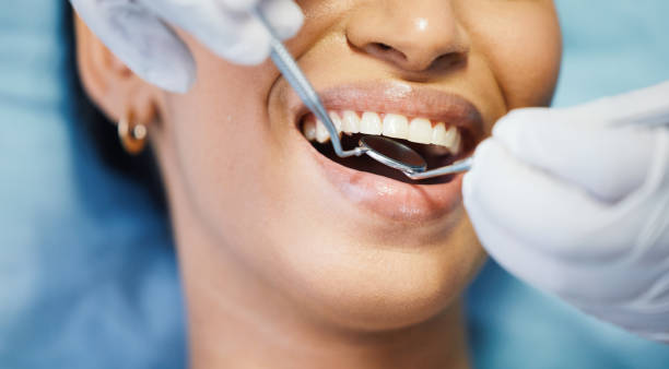 Best Tooth Pain Emergency Relief  in Hermann, MO